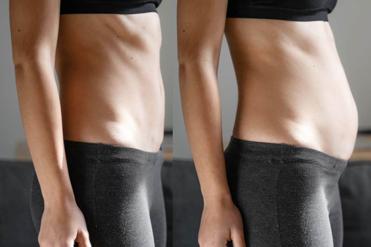 How long does diastasis recti take to improve Altrincham?