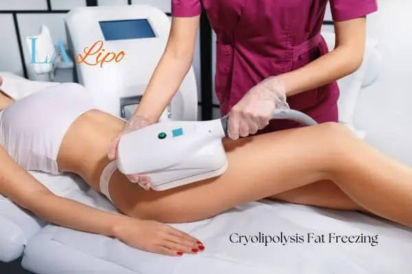 Woman receiving coolsculpting Altrincham treatment on her thighs