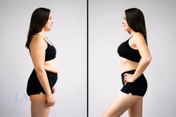 link between body image and mental health Altrincham