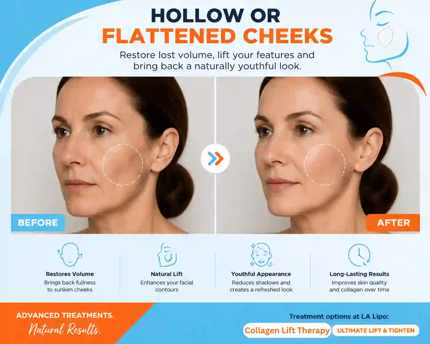 Sign #4: Hollow or Flattened Cheeks Altrincham