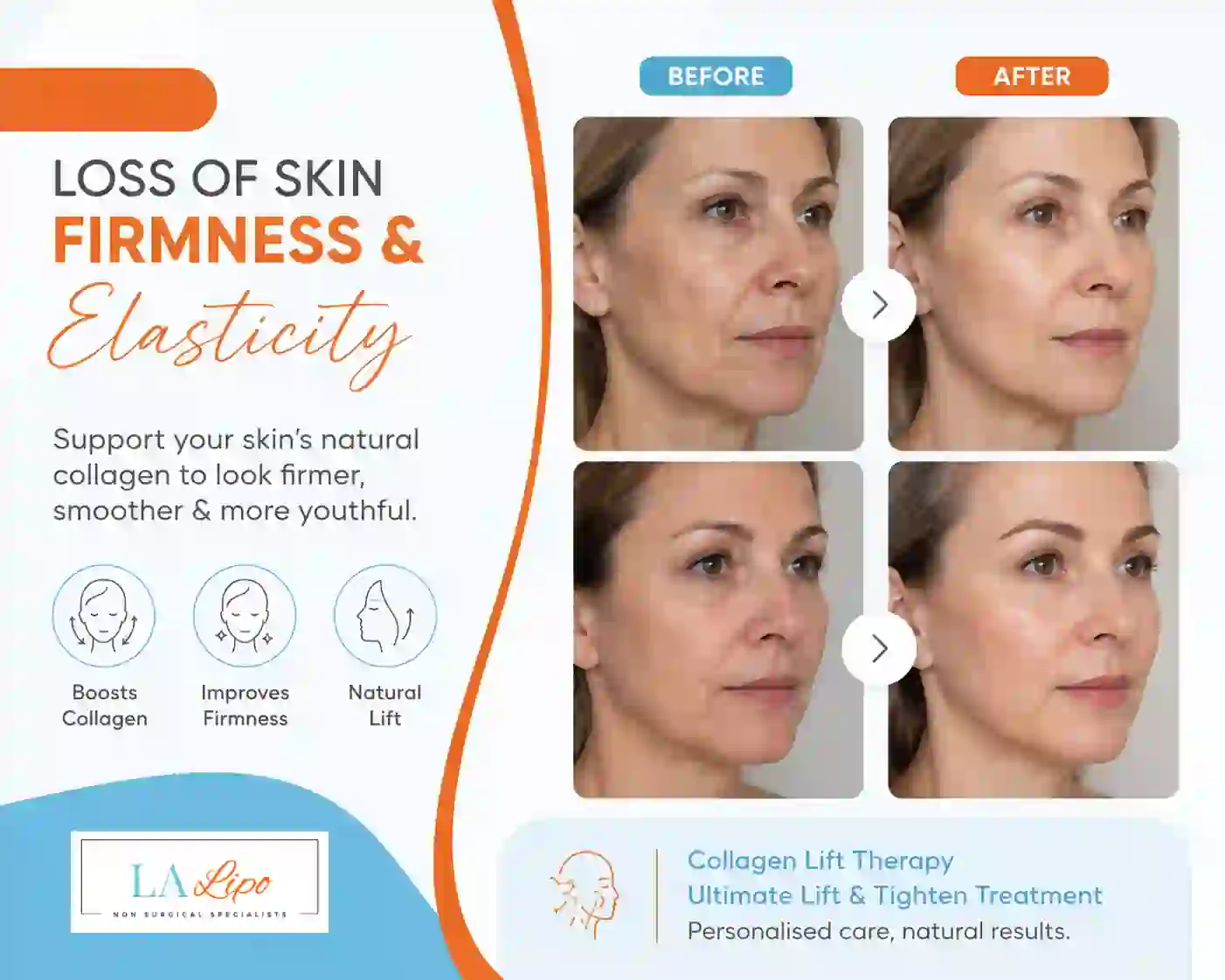 Sign #7: Loss of Skin Firmness and Elasticity Altrincham