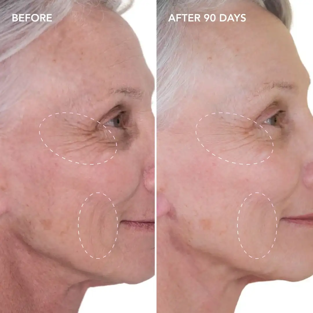 When will you see results Altrincham